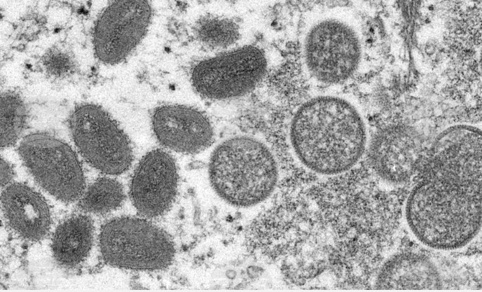 В Турция е регистриран първи случай на маймунска шарка